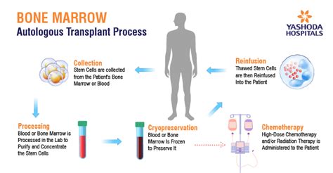 bone marrow transplant pcso|Bone marrow transplant .